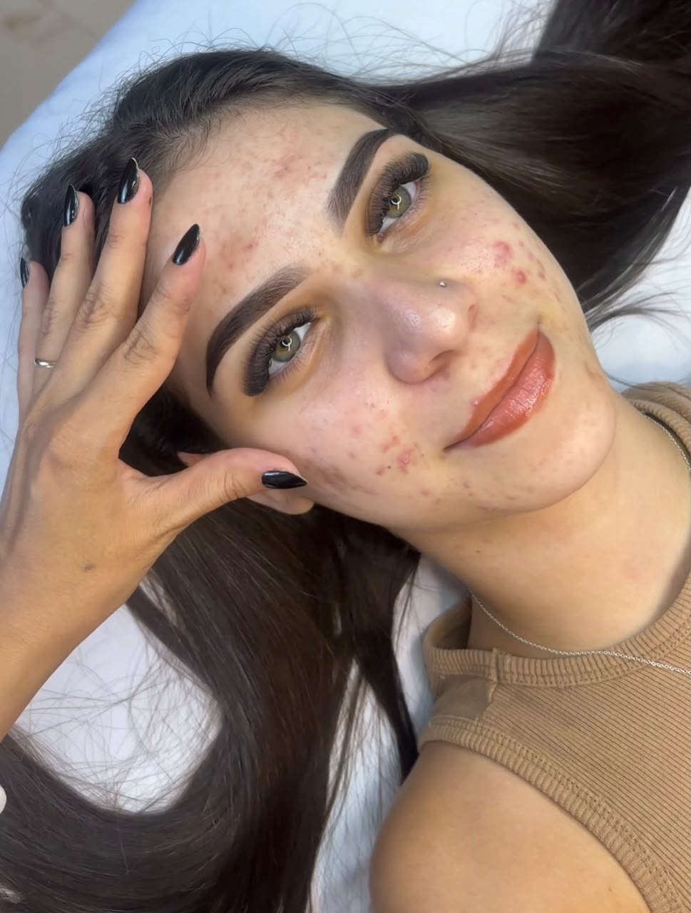 Foto de unhas antes de aplicar o método